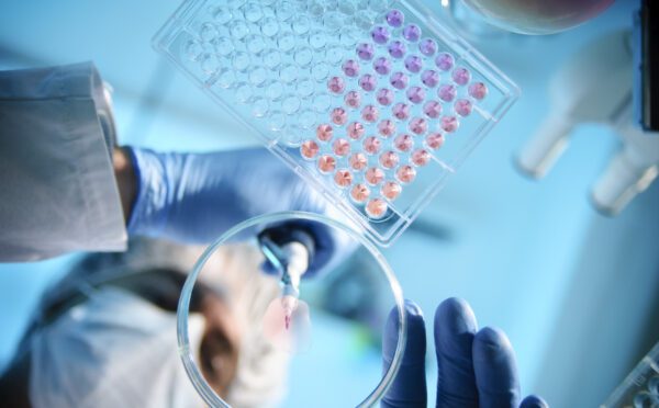 Department of Finance releases consultation papers on patent box regime and SR&ED